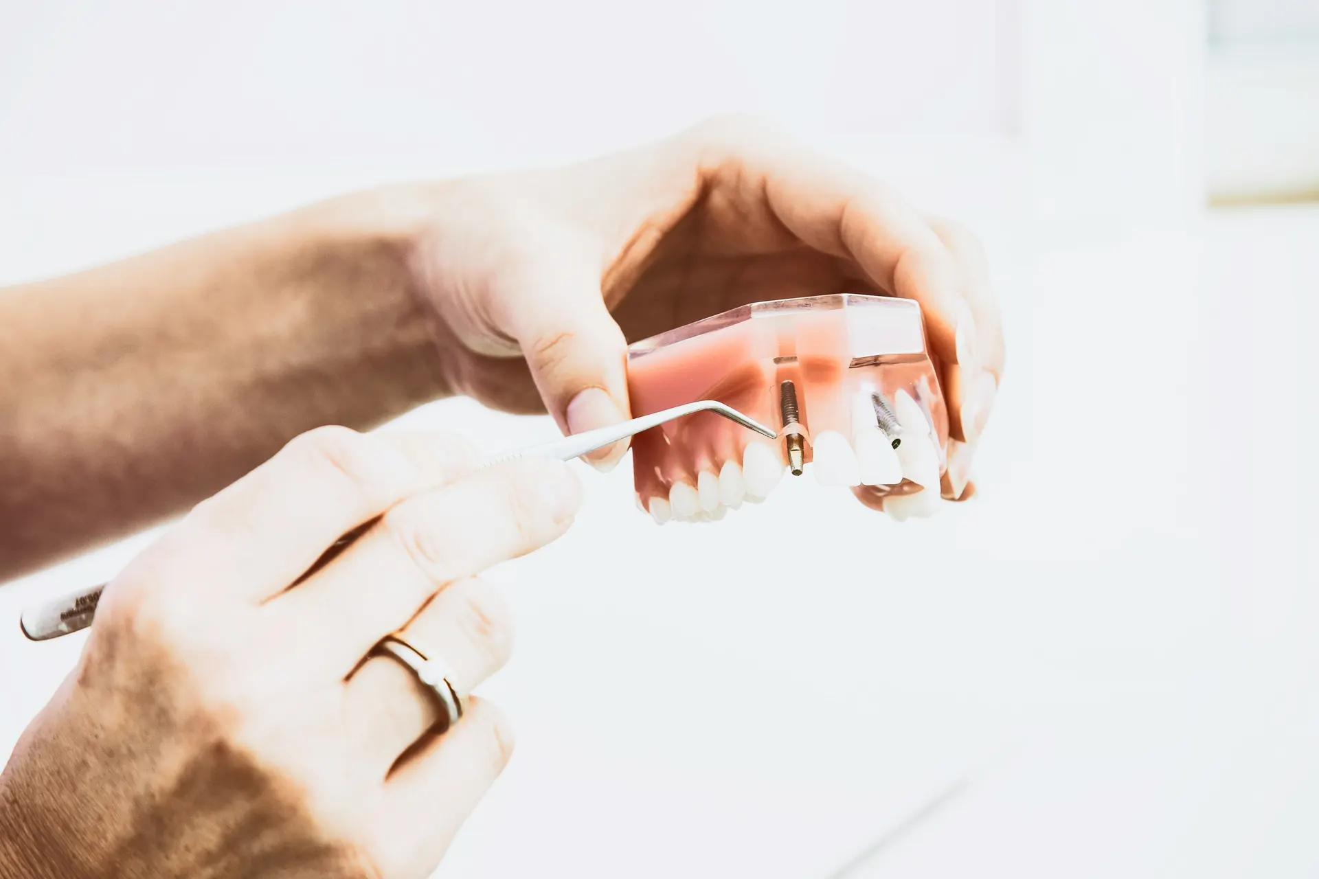 Model dentar folosit în evaluarea stomatologică